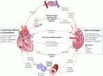 Cardiorenal_syndrome_pathophysiology_2_Mbah_Dukun_Bagong
